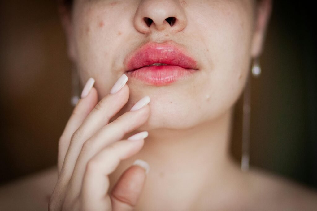 Contour des lèvres irrité : causes, soins apaisants et solutions efficaces